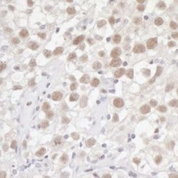 FEN-1 Antibody, Novus Biologicals 100 &mu;L | Buy Online | Novus Biologicals | Fisher Scientific